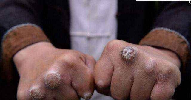 明星繭，小巷深處的隱秘瑰寶