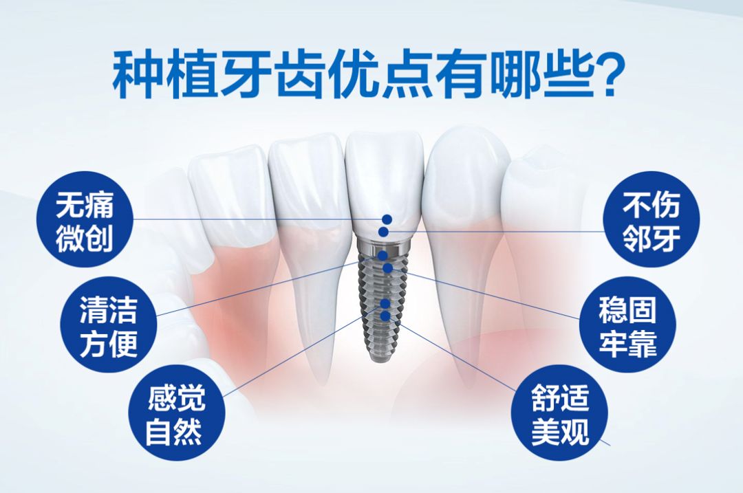 科技重塑口腔美學,種植牙最新消息,開啟智能種植新紀元